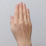 シミを作らないようにするには?